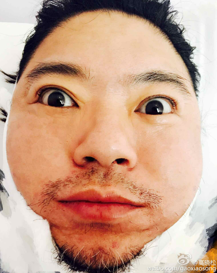 你最丑的照片是怎样的?