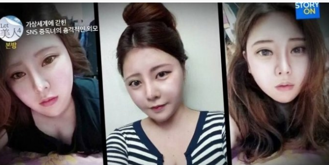 你所不知道的日本整容手术 日式审美与小颜术 知乎