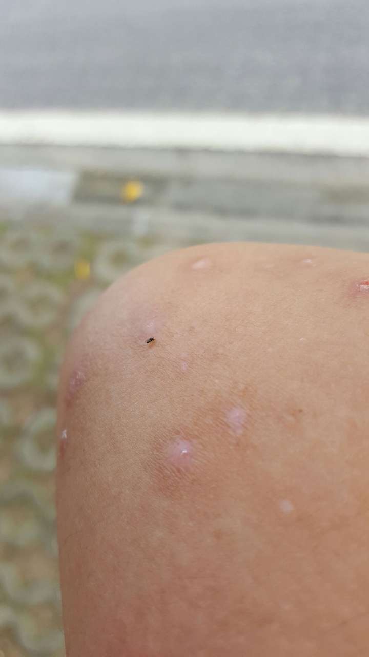 被一种很小黑色的小虫子咬,.