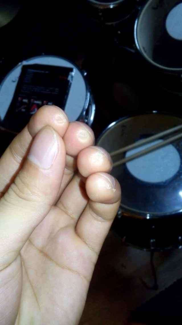 长期弹吉他,按和弦的手指会发生什么变化?