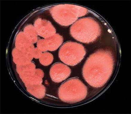 一种细菌长在不同的营养物质上颜色一样吗?