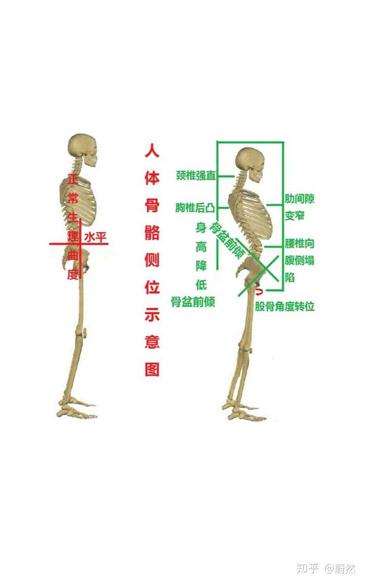 鸡胸!还是平胸!纯平!是否还能隆胸?