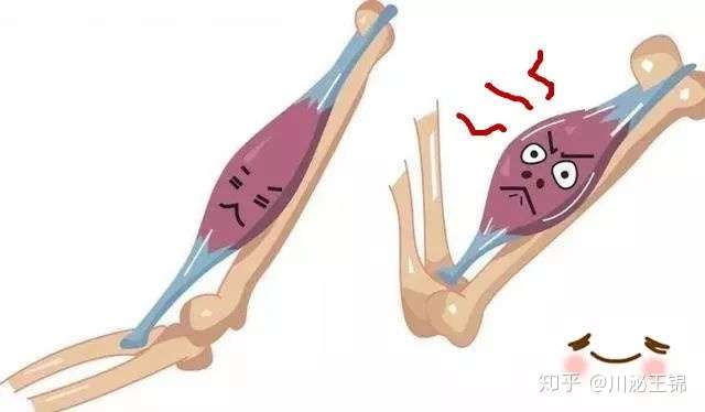 收藏 血液透析过程中肌肉痉挛的那些事 知乎