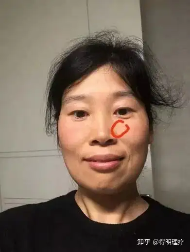 老师讲中医师讲鼻炎大秘密