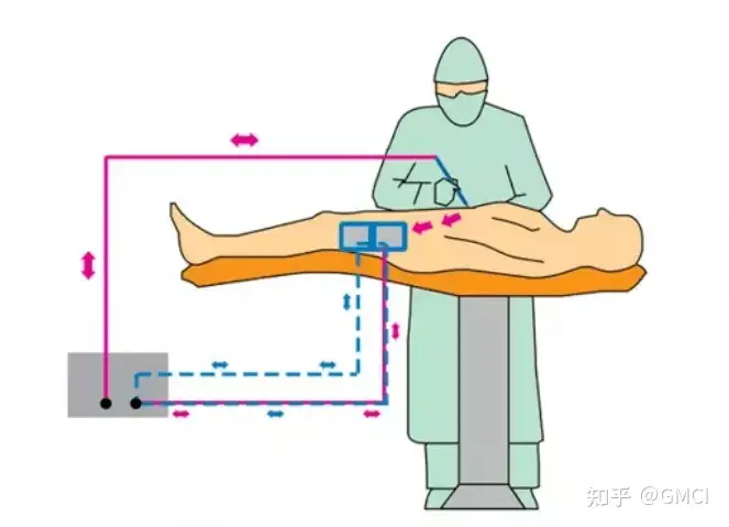 德國GMC醫(yī)療質(zhì)控提供高頻電刀測試方法插圖6