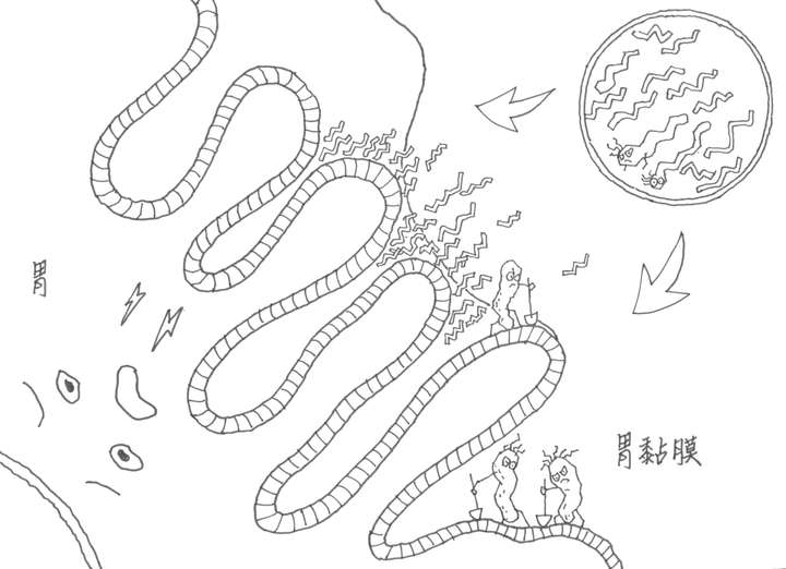 幽门螺杆菌简笔画图片