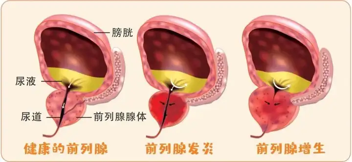 粒姊色常见它痴轴上(图2)