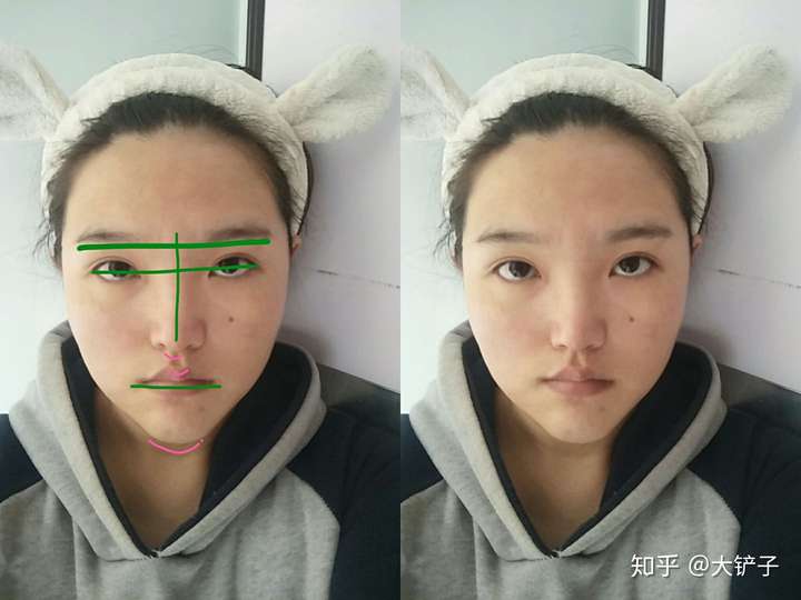 如何判断下颌左歪还是右歪?