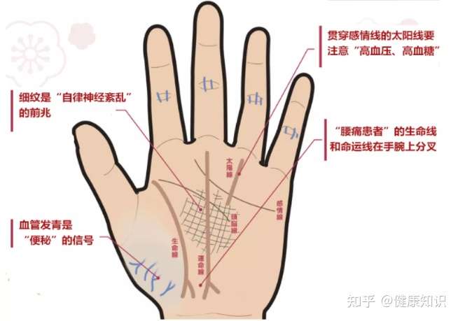 健康运势 看手相就知道身体的不适 感情线高血压 生命线腰痛 知乎