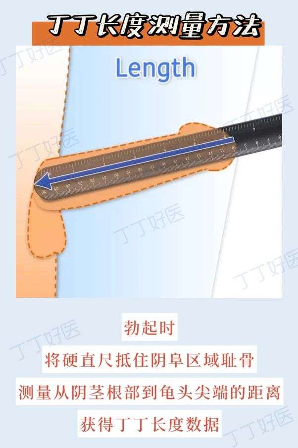 丁丁小运 的想法: 【丁丁小运教你:如何正确测量丁丁长度(… - 知乎