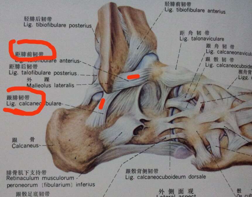脚踝韧带断裂经历分享 知乎