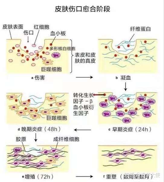 手术后伤口多久能愈合 健康管家分享吃什么愈合快 知乎