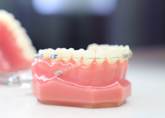 牙齿矫正受什么因素影响？