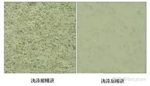 借卵费用（试管婴儿诞生的全过程）