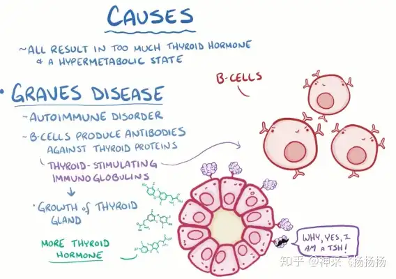 医嗓棵噪丧撤泳营徐阁躯进 Hyperthyroidism(图4)