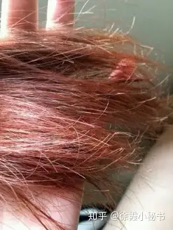 发质不好怎么办