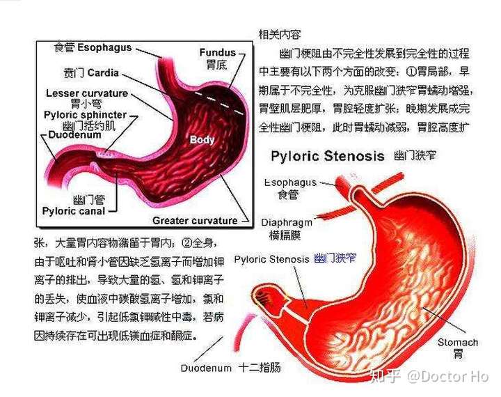 胃幽门图解图片