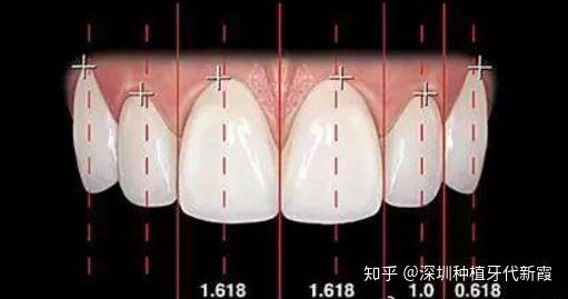 牙体长轴图片图片