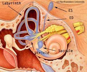 耳朵双侧前庭导水管扩大怎么办?