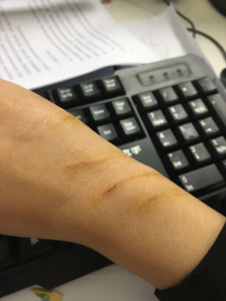 你被猫抓得最惨的一次到什么程度?