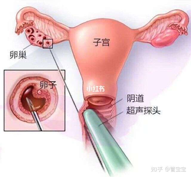 为什么试管过程中会出现取卵少的问题 知乎