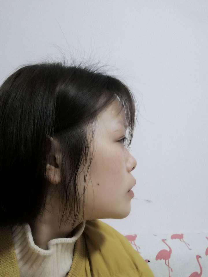 脸正面好看侧面不好看是一种怎样的体验?