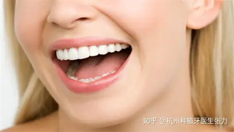 现在种植牙多少钱一颗,种牙得花多少钱