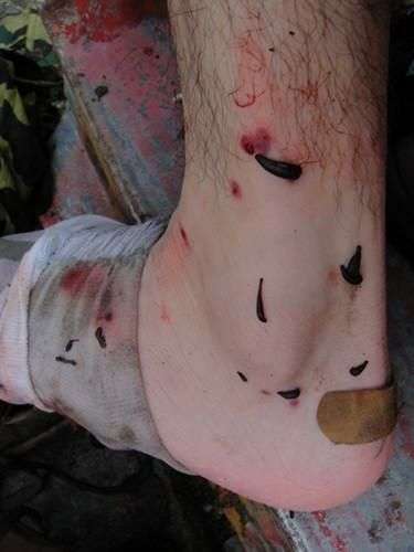 里面有很多吸血虫,蛆虫,病菌.