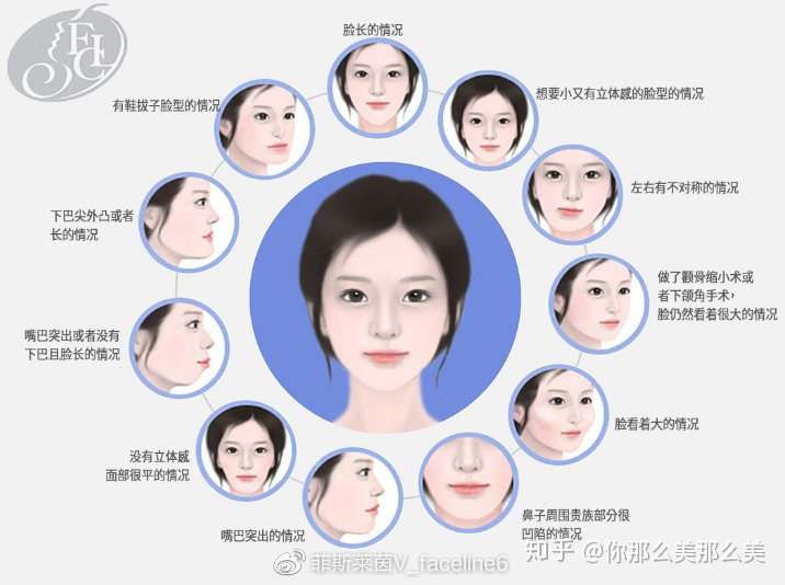 韩国双鄂手术中国正颌手术有什么区别 知乎