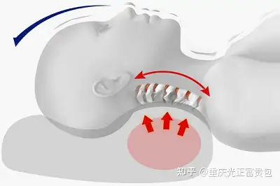 预防富贵包的睡姿图片