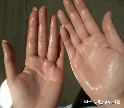 手脚心出汗 zhuanlan.zhihu.com
