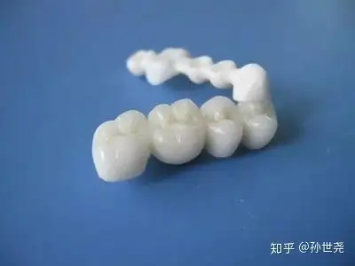 镶牙要多少钱一颗？