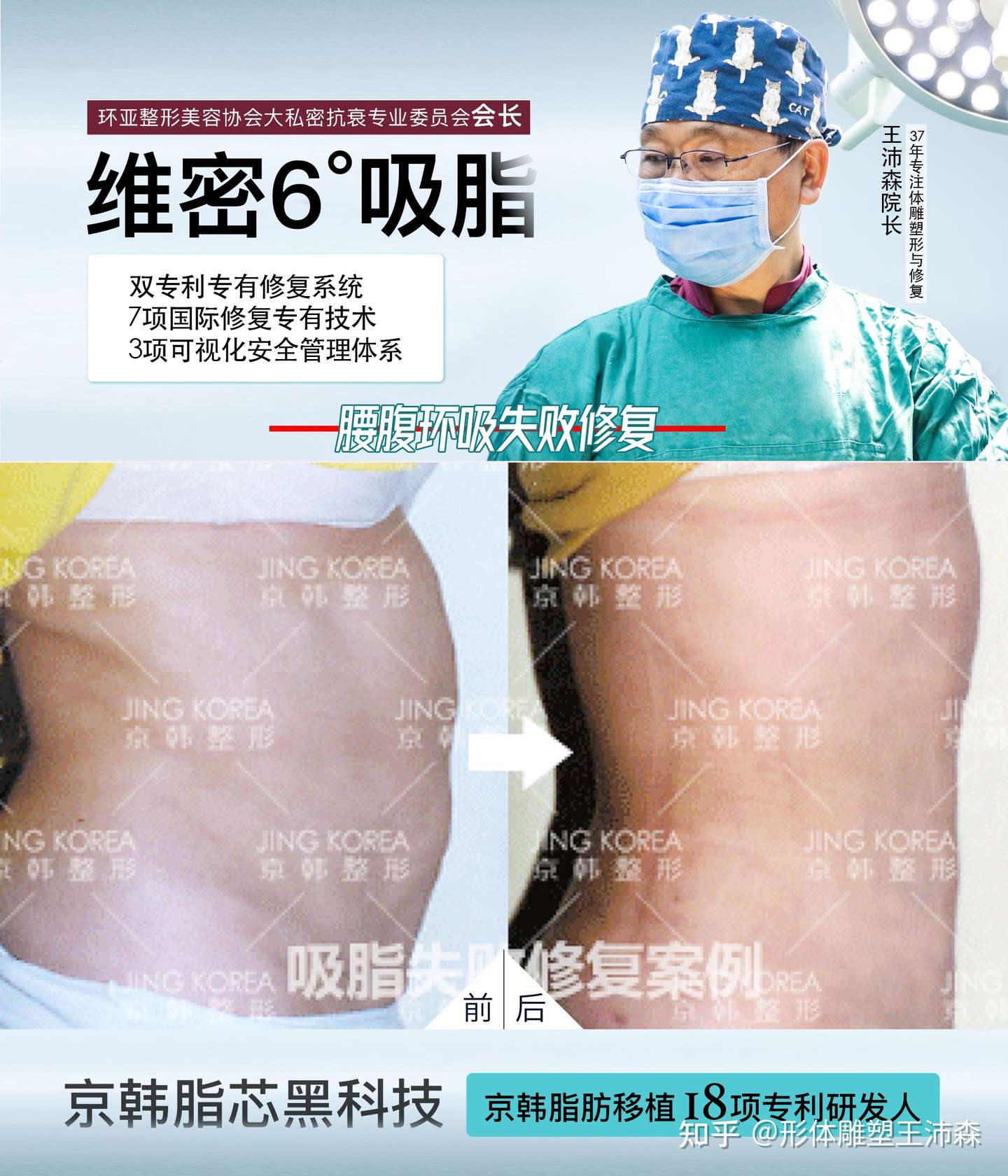 大腿吸脂失败有哪些现象 如何才能有效避免吸脂手术失败 知乎 大腿吸脂失败有哪些现象 如何才能有效避免吸脂手术失败 知乎