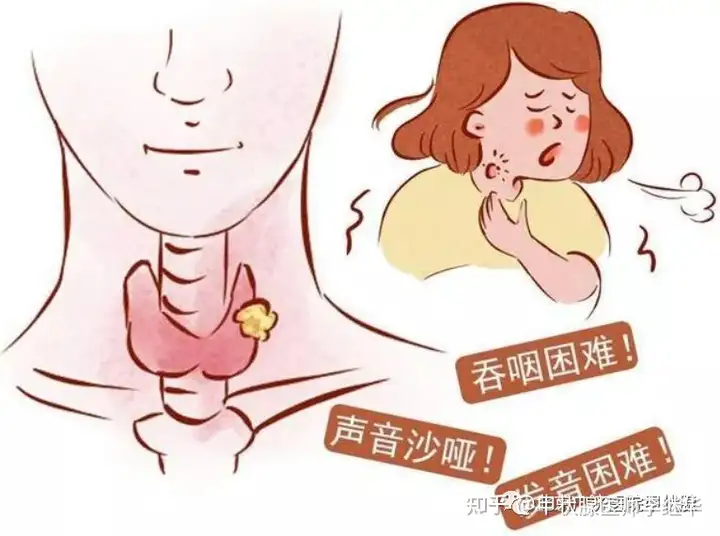 中医解读甲状腺结节、甲亢、甲减，弄懂这些，治疗起来事半功倍（甲状腺结节的中医辩证论治好大夫）