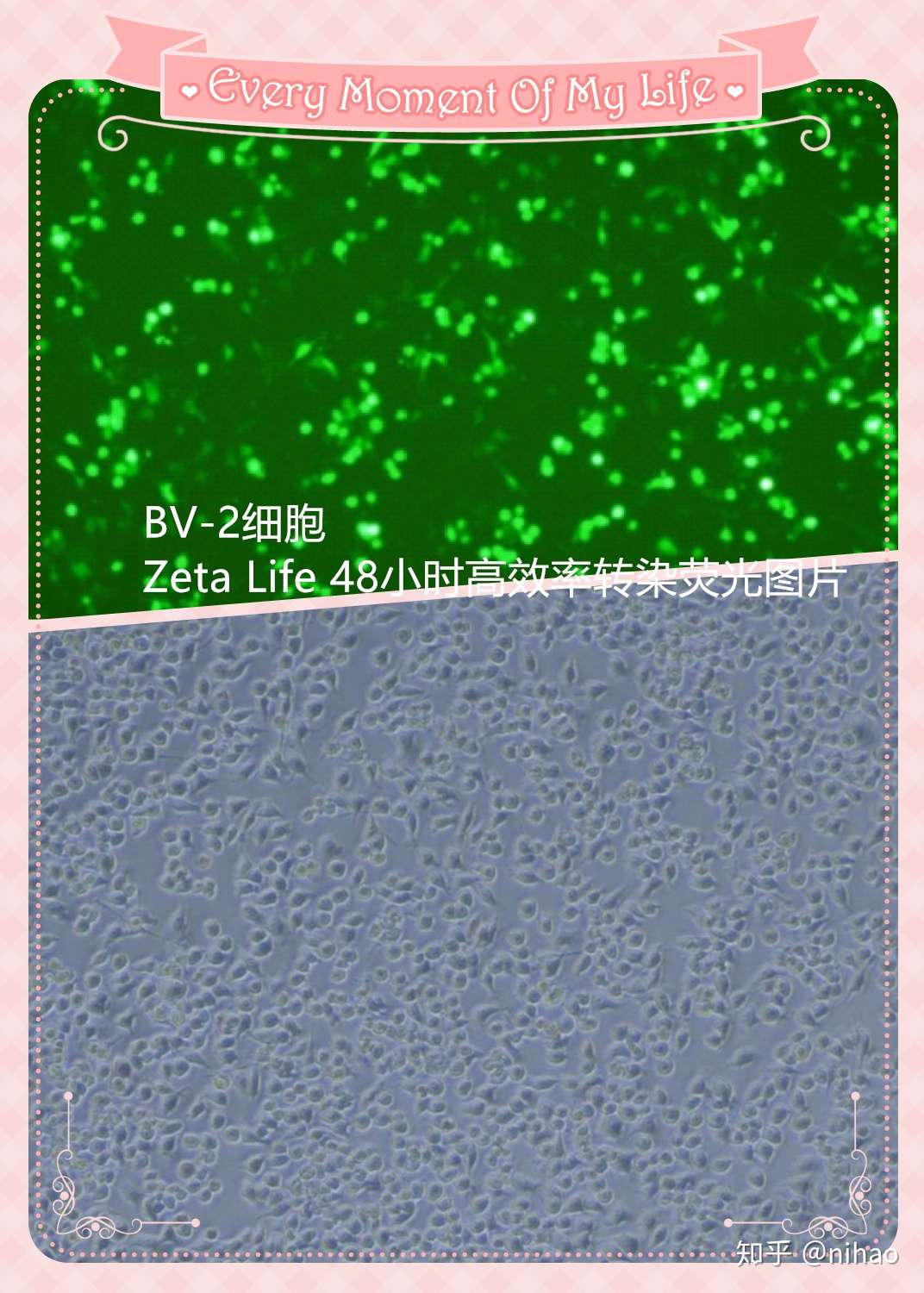 转染bv 2小鼠胶质瘤细胞 高效率转染bv 2小鼠胶质瘤细胞 知乎