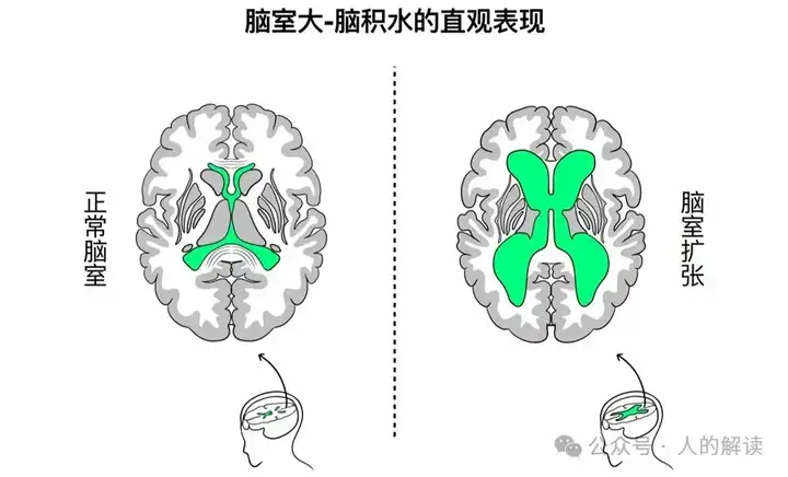 奇特的全息大脑，世界竟然是投影-人的解读