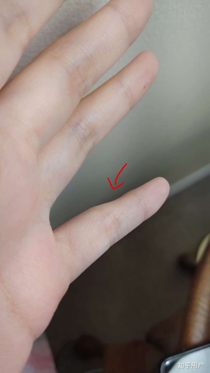 头几天时,用过手机小拇指就有一个压痕,一个月后,小拇指上硌出了一个