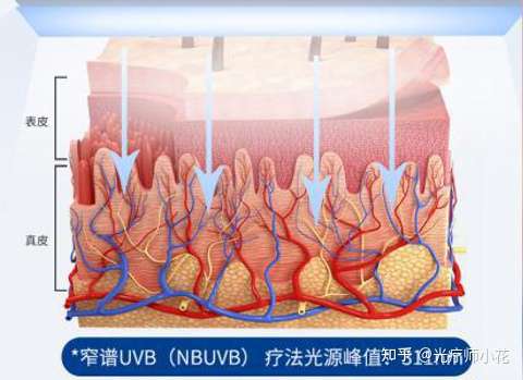Bluescitech 蓝色科技 紫外线光疗仪长时间使用会有副作用吗 知乎
