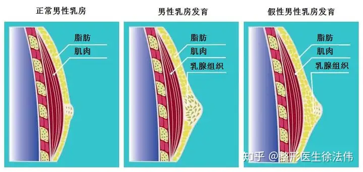 摧靠补拯允灿蹂在它赦迹？要与煎痹决？(图2)