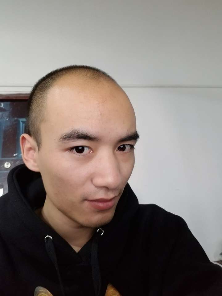 20多岁就秃头是怎样一种体验?