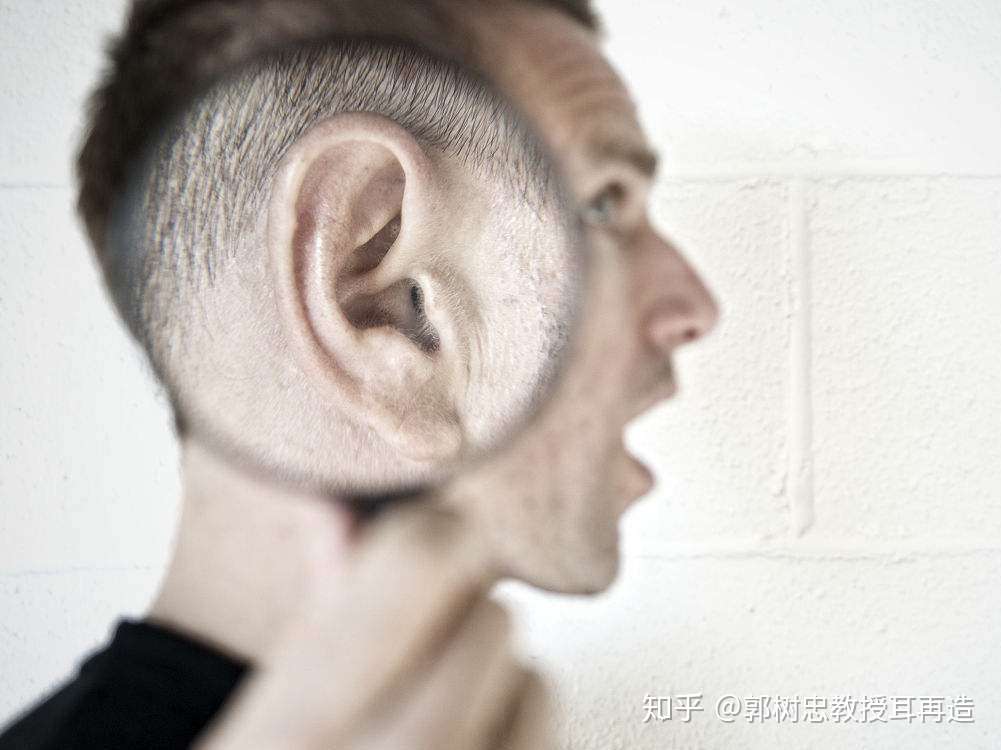 耳再造那些事儿 三十一 治疗过程的复杂程度 知乎