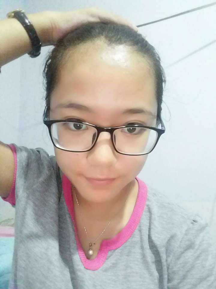 发际线高额头也高的女生适合什么样的发型内附大量明星参考图