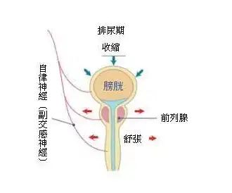 从男性角度来说,长期反复憋尿,可能会导致慢性前列腺炎