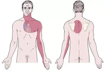 Chart by physical therapist