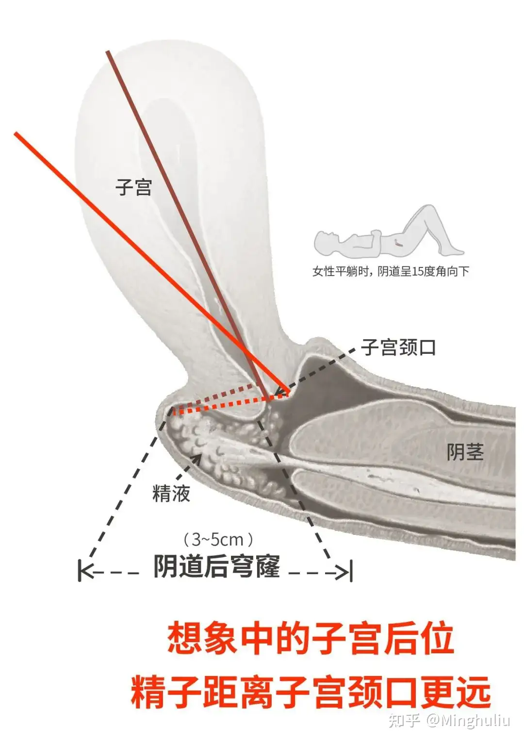 後 測位