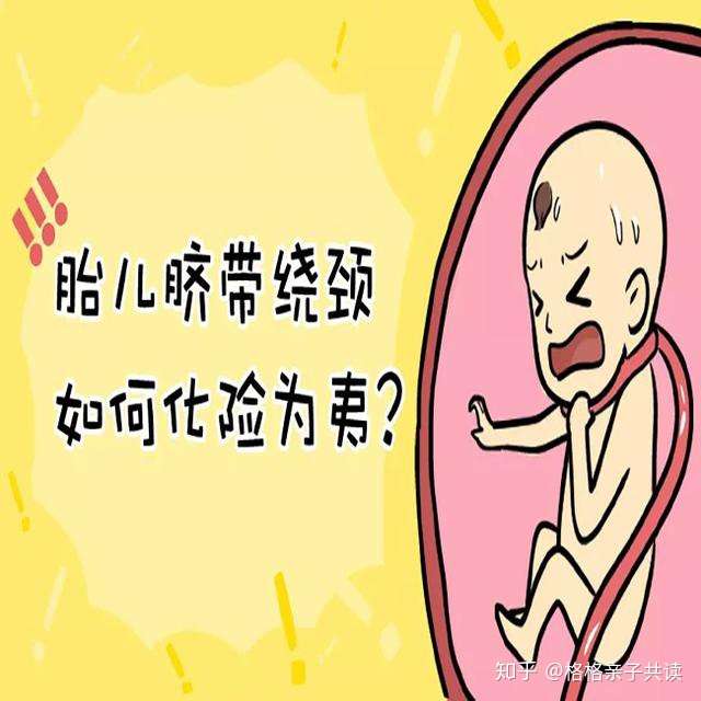 怀孕做b超的时候医生说脐带绕颈一圈 产科主任说不要紧 真的吗 知乎