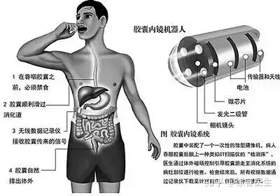 胶囊胃镜一次多少钱?有什么缺点?和普通胃镜有什么区别?