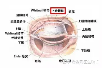 提肌手术动画图片