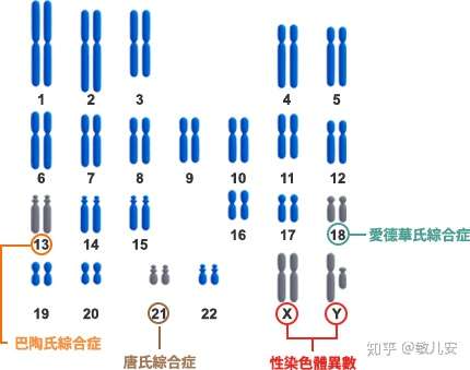 染色体微缺失"小儿猫叫综合征"有哪些危害?