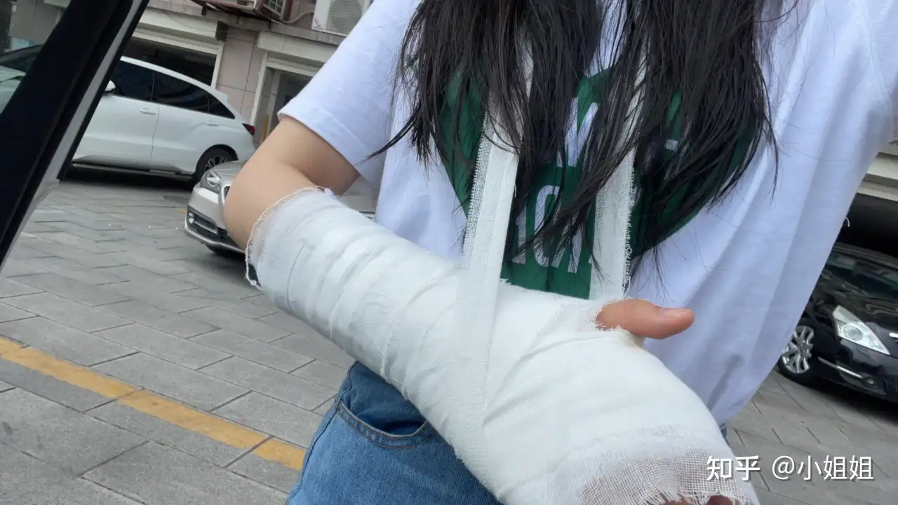 小姐姐舟骨骨折日记 知乎